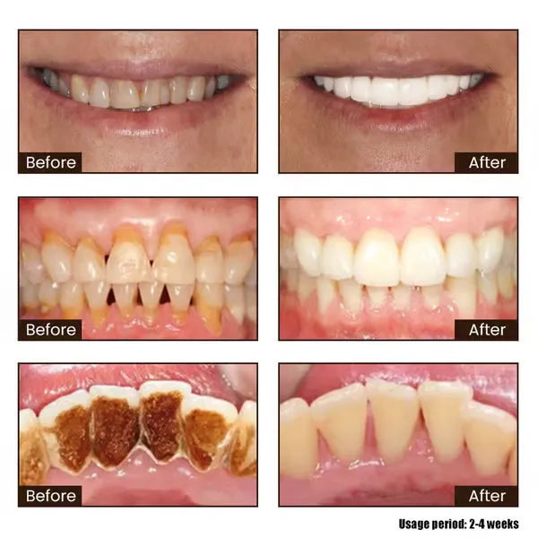 New 7-Pro Intensive Toothpaste features upgraded purple probiotic formula for deep enamel repair and long-lasting freshness